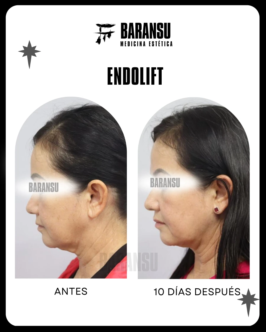 Endolif